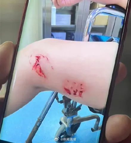 多名游客下海被不明生物咬伤！广西一地凌晨回应